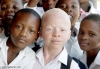 afrikada albino olmak