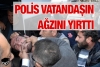 polis tarafından ağzı yırtılan kürt / #714067