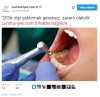 20 lik diş ameliyatı / #964934